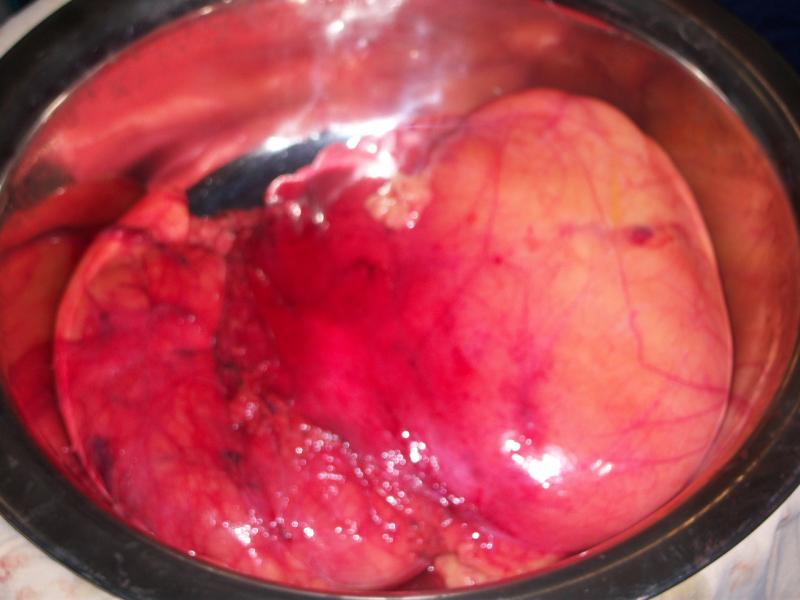 http://www.ncbi.nlm.nih.gov/pubmed/22699472