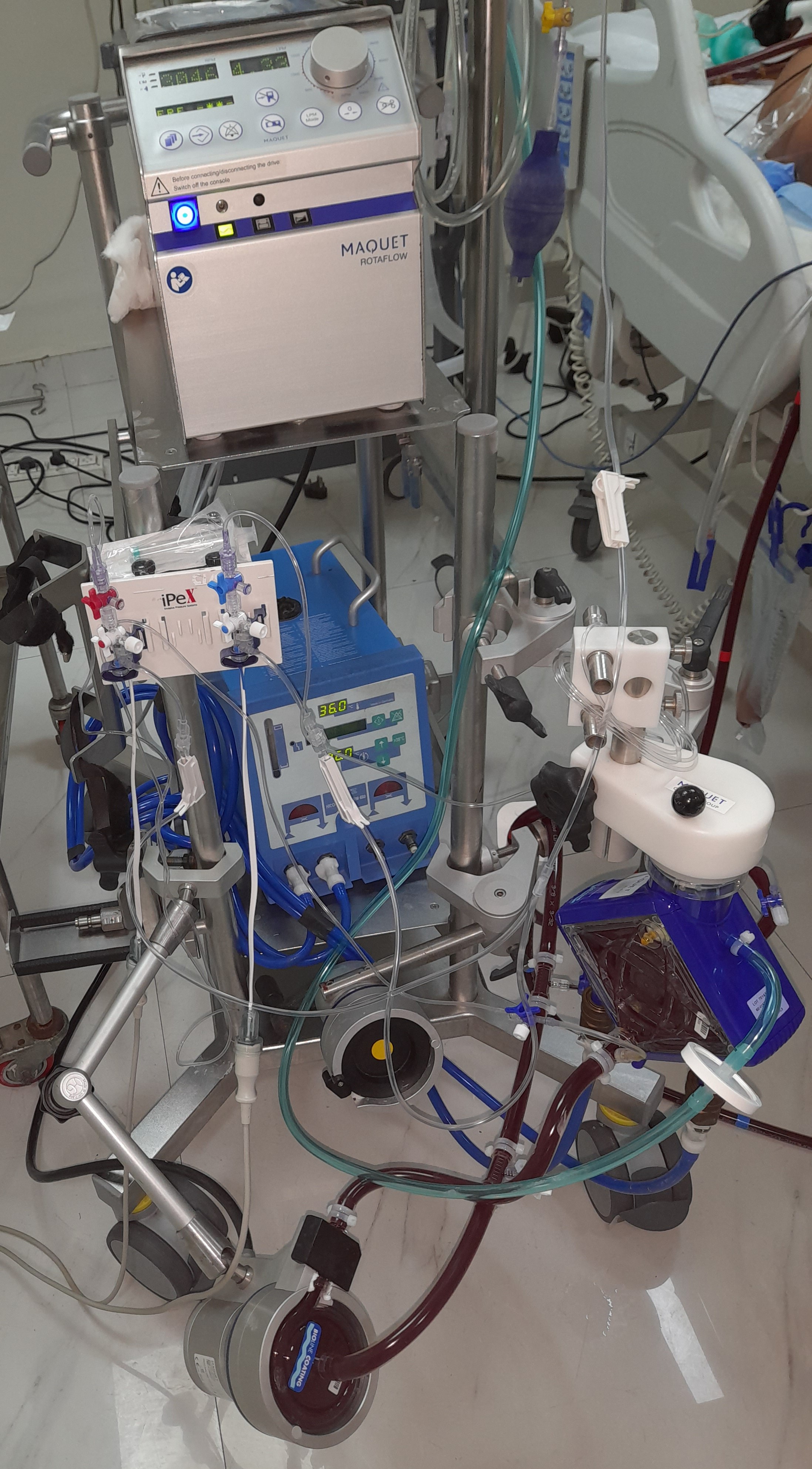 Dr Avinash Dal and ECMO