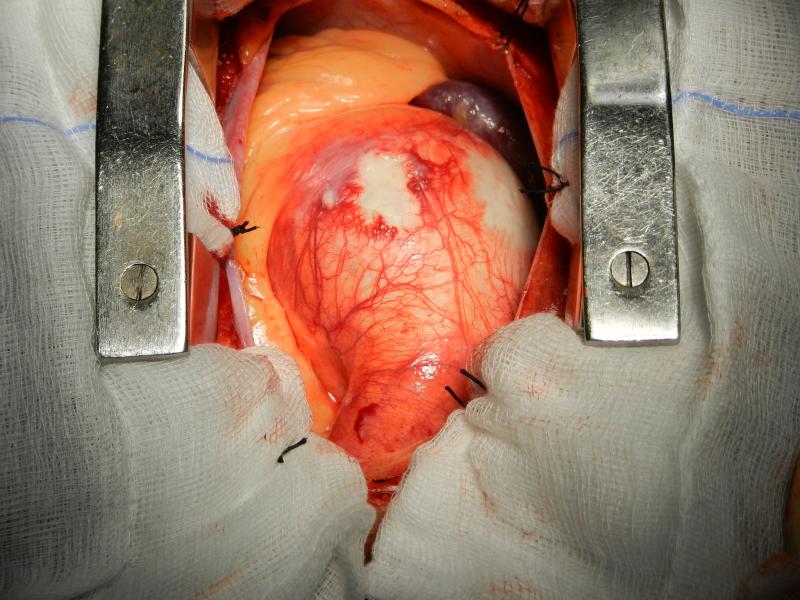 aneurysm seen on opening chest